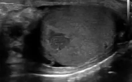 Ecografia Muscolo-Scheletrica (MSK)