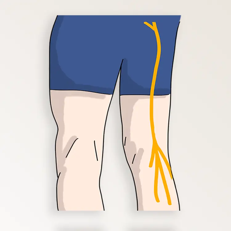 Ecografia Muscolo-Scheletrica (MSK)
