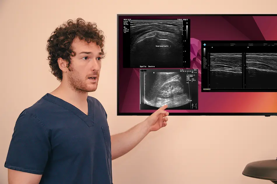 rosario marangio spiega ecografia